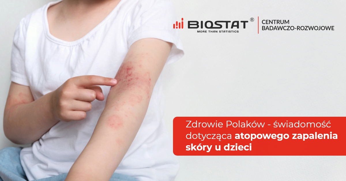 Sondaż BioStat® dla WP: Atopowe Zapalenie Skóry u dzieci